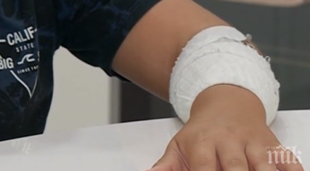 нова опасна игра деца изгарят кожата получат магични сили