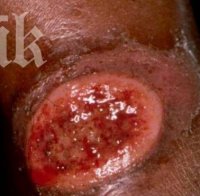 Нови болни от дум-дум треска