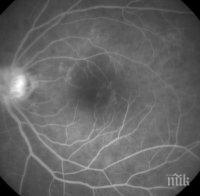 ПРОБИВ: Биолози създадоха човешка ретина