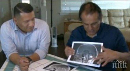 чудо мозъчен тумор изчезна мистериозно пациентът опериран снимки