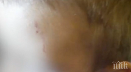 родители жалват агресивно дете бие рита хапе нашите детската градина