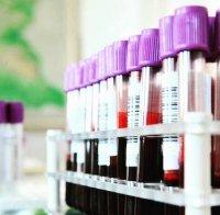 В Перник изследват безплатно за СПИН, хепатит и сифилис