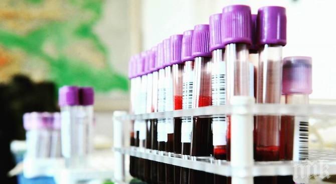 В Перник изследват безплатно за СПИН, хепатит и сифилис