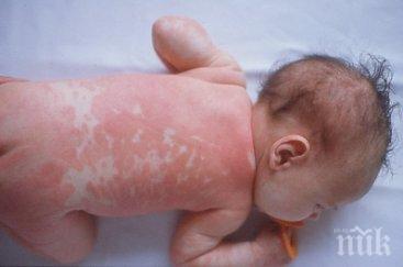 ужас бебета румъния заразени златист стафилокок