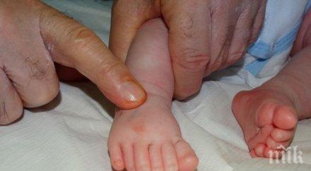 лекари бургас оперираха успешно бебе шест пръста