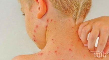 варицелата завръща детски градини перник карантина