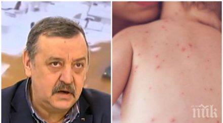 официално души заразените морбили нас