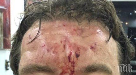 брутално венецуелски полицаи пребиха полски журналист