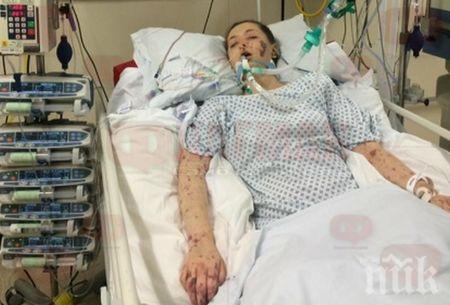 ТРАГЕДИЯ: Менингит уби 36-годишна бургазлийка