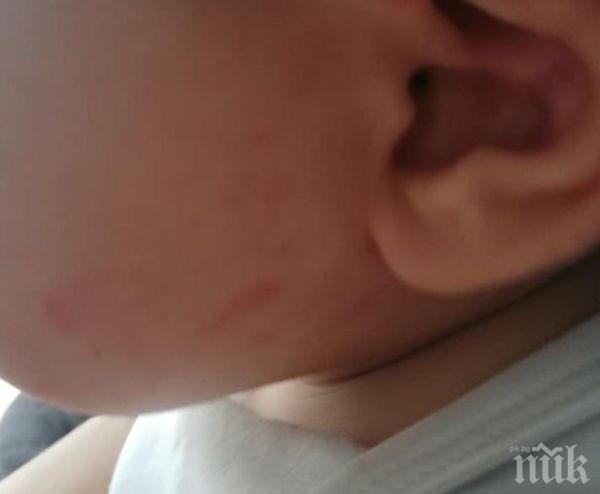 Майка пропищя от гледачка, обезобразила детето й (СНИМКИ)