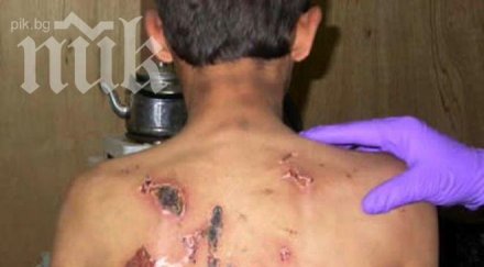 британец съблечен наръган турция заради целувка местна