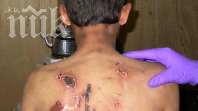 Британец съблечен и наръган 17 пъти в Турция заради целувка с местна

