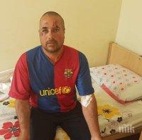 ЗВЕРСТВО: Баща и син пребиха брутално с метални тръби мъж във Врачанско (СНИМКИ)