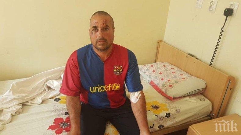 ЗВЕРСТВО: Баща и син пребиха брутално с метални тръби мъж във Врачанско (СНИМКИ)