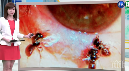 хорър извадиха четири живи пчели окото тайванка хранили сълзите