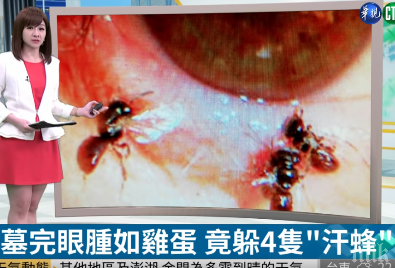 ХОРЪР: Извадиха четири живи пчели от окото на тайванка, хранили се със сълзите й