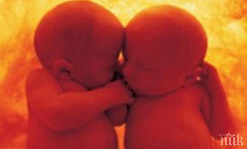 НЕВИЖДАНО: Бой между близнаци в утробата на майката (ВИДЕО) 