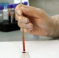 100 българи пипнаха сифилис, най-много са във Варна, София и Пловдив