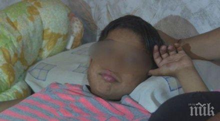 семейството детето забита ножица главата чакало линейка повече час