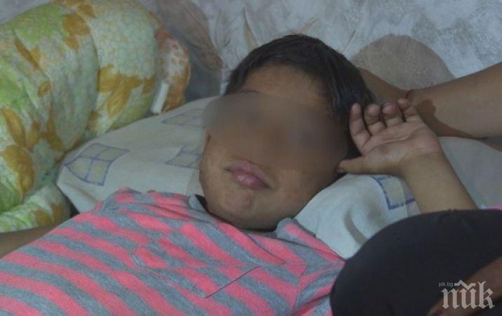 Семейството на детето със забита ножица в главата чакало линейка повече от час 