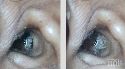 тотален шок лекар откри гнездо паяк ухото пациент видео