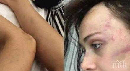 известна топмоделка обезобразена зверски побой приятеля