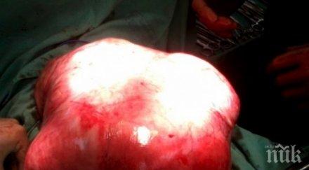 шокиращи данни 1980 насам злокачествените заболявания българия скочили тройно