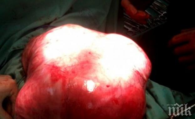 ШОКИРАЩИ ДАННИ: От 1980 г. насам злокачествените заболявания в България са скочили тройно