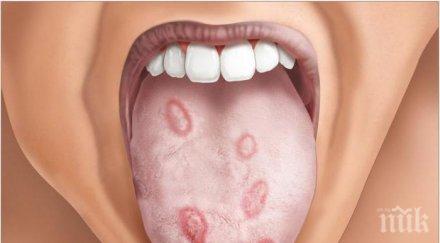 опасен секс бум сифилис европа 260 000 потвърдени случая