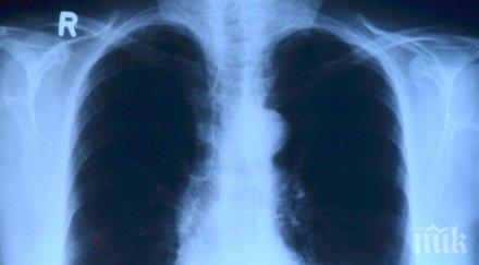 симптома разкриват рака белия дроб