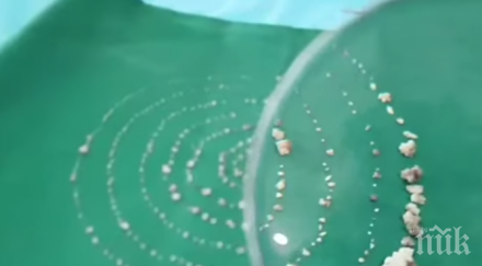 аномалия извадиха 526 зъба устата годишно дете снимка