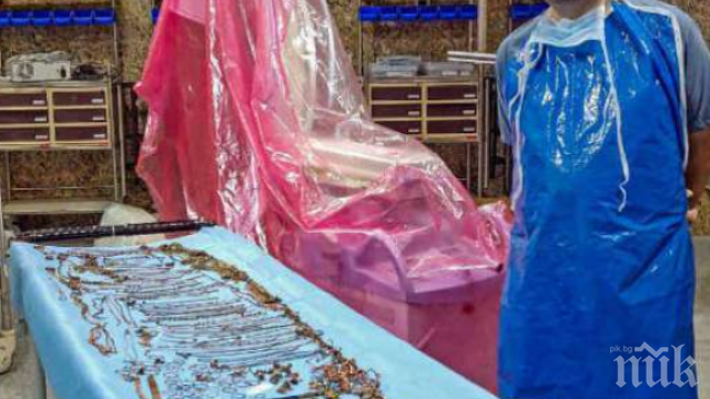 ШОК: Хирурзи извадиха от стомаха на жена 1,5 кг накити 