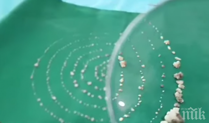 АНОМАЛИЯ: Извадиха 526 зъба от устата на 7-годишно дете (СНИМКА)