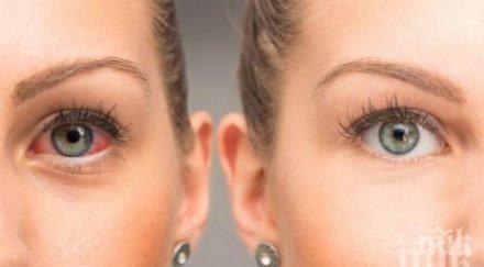 опасно паренето очите симптом смъртоносна болест