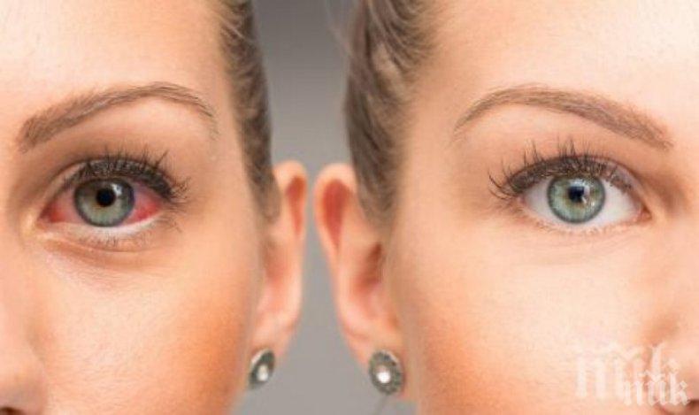 Опасно! Паренето на очите е симптом на смъртоносна болест