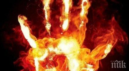 бум пациенти изгаряния русенска болница