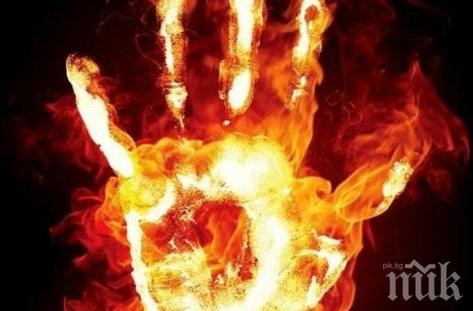 Бум на пациенти с изгаряния в русенска болница