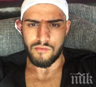 Чужденци нападнаха млад мъж в столицата, строшиха бутилка в главата му