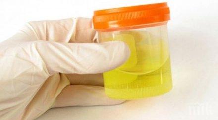 здравословно издава здравето цветът урината