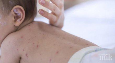зараза скарлатина повали пет деца седмица пловдив околията