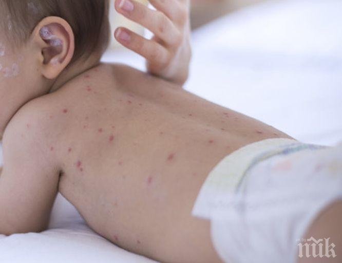 ЗАРАЗА: Скарлатина повали пет деца за седмица в Пловдив и околията