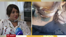 Куче разкъса плеймейтка от "Игри на волята"! Марешка Бардем на косъм от смъртта, раните са на сантиметри от сънната артерия (ШОКИРАЩИ СНИМКИ)