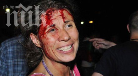 окървавената жена протеста бойко прави жалък пиар мой гръб