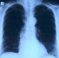 Диагностицират 4250 нови случая на рак на белия дроб