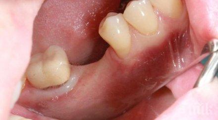 избиха зъб годишно момче спортна площадка благоевград