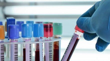 шок откриха сифилис годишно момиченце