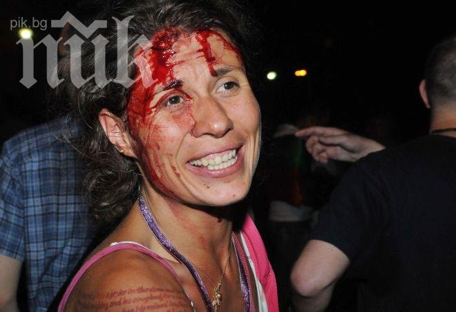 Жената с окървавената глава на протеста: Жалкият Бойко ни разгони фамилията за 4 години