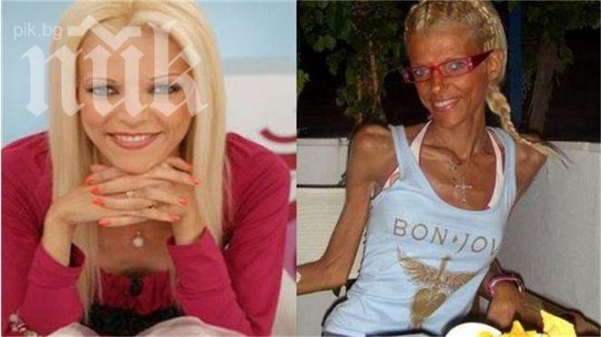 Анорексия погубва гръцки секссимвол 