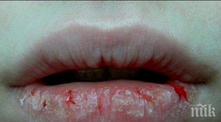 какви пораженията инжектиране витамини лицето