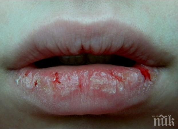 Ето какви са пораженията от инжектиране на витамини в лицето